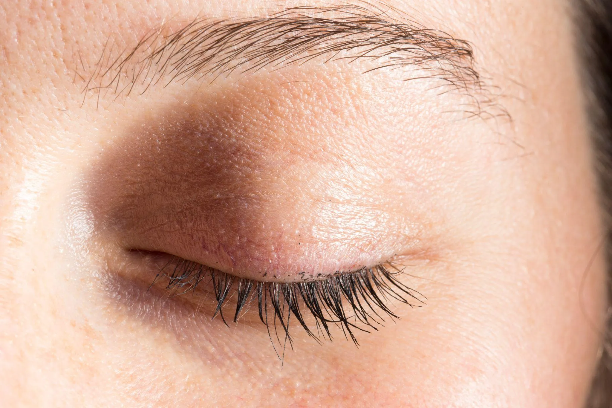 網膜剥離はどんな病気？