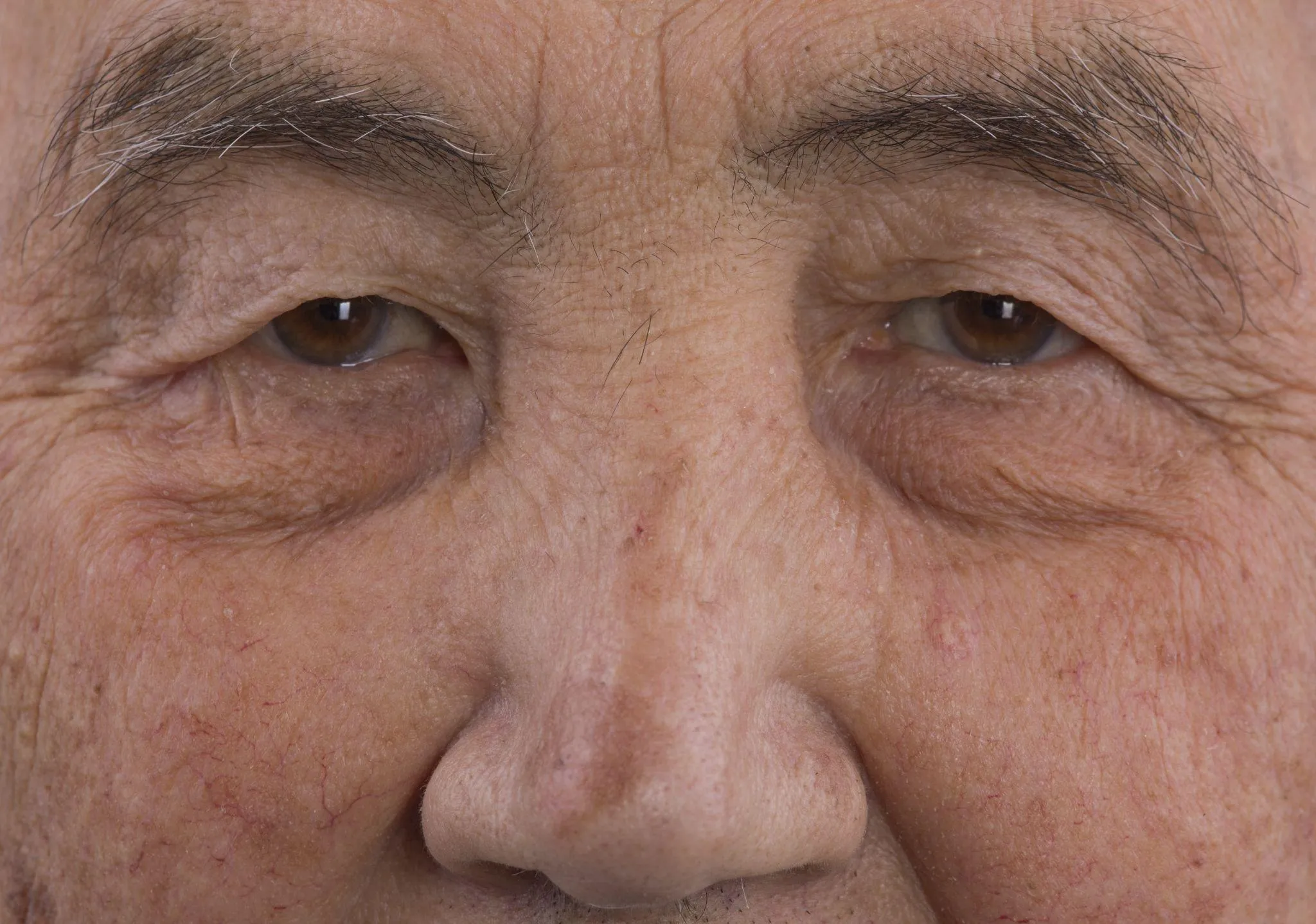 加齢でまぶたが下がる？理由や眼瞼下垂との関係とは